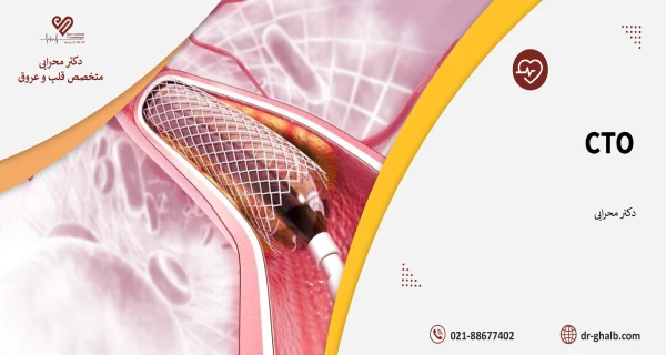باز کردن انسداد عروق کرونر با روش کم تهاجمی CTO