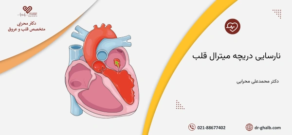 نارسایی دریچه میترال قلب