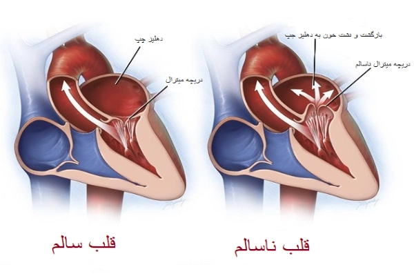 قلب سالم و ناسالم