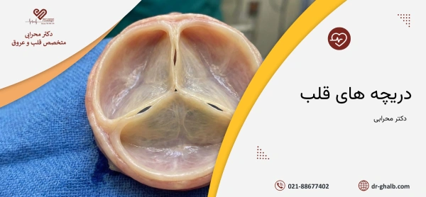 وظیفه دریچه قلب، انواع ان و علائم مشکل دریچه قلب